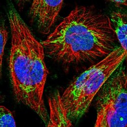 ABCB8 Antibody, Novus Biologicals 0.1mL; Unlabeled:Antibodies, Polyclonal